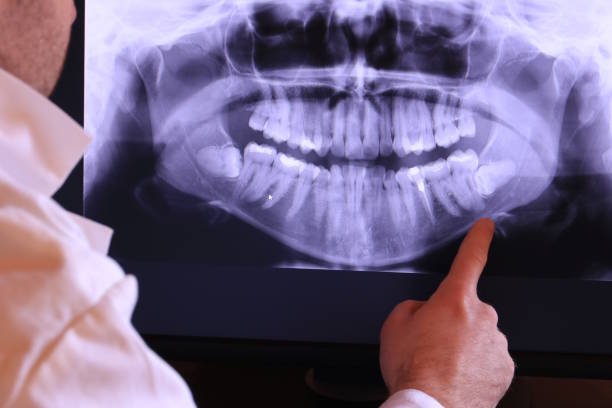 Best Broken or Cracked Tooth Emergency Dentist in Artondale, WA